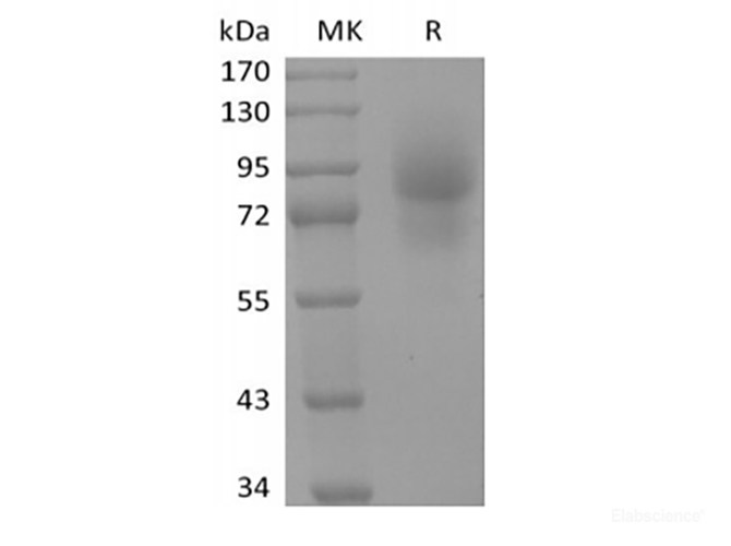 Recombinant Human CD68/SR-D1 (C-Fc)