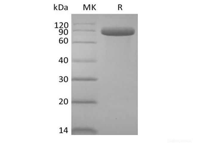 Recombinant Human Delta-like Protein 4/DLL4 (C-Fc)