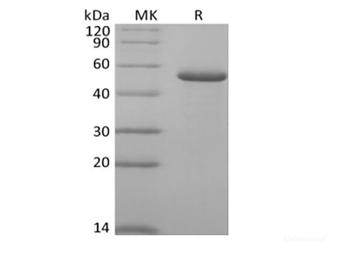 Recombinant Human RCN2 (C-6His)