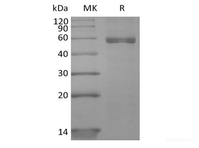 Recombinant Human HLA-A*0201 NY-ESO-1 complex Protein (C-10His)