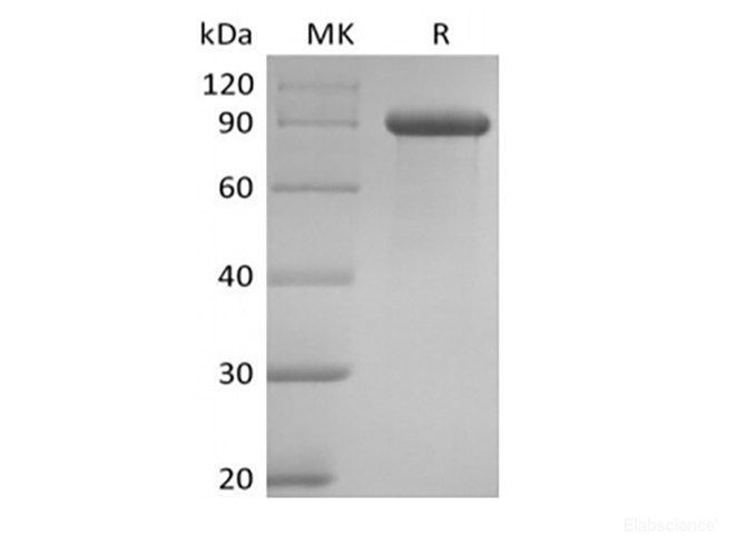 Recombinant Human Delta-like Protein 1/DLL1 (C-Fc)
