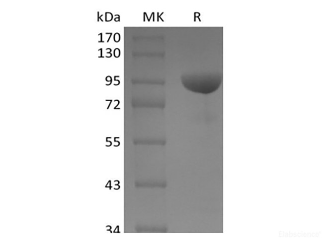 Recombinant Human Ephrin B Receptor 1/EphB1 (C-Fc)
