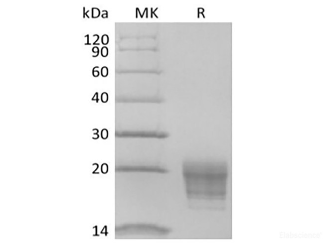 Recombinant Human IL-5 (C-6His-Avi) Biotinylated
