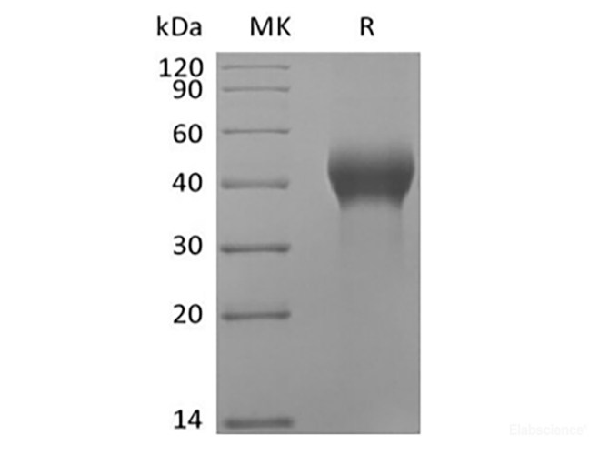Recombinant Human Dickkopf-Related Protein 1/DKK-1 (C-Avi-6His) Biotinylated