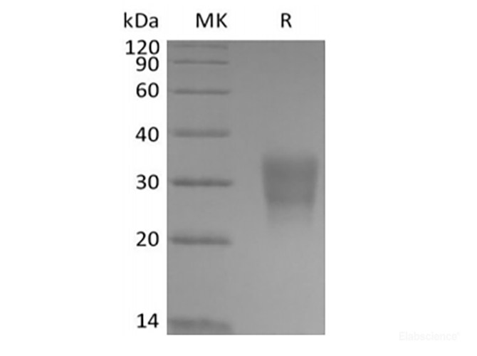 Recombinant Human Frizzled-8 (C-6His-Avi) Biotinylated