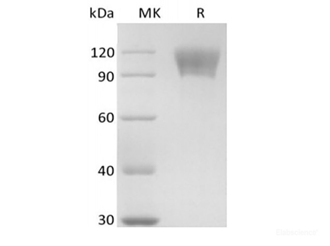 Recombinant Human TNFRSF8/CD30L Receptor/CD30 (C-mFc)