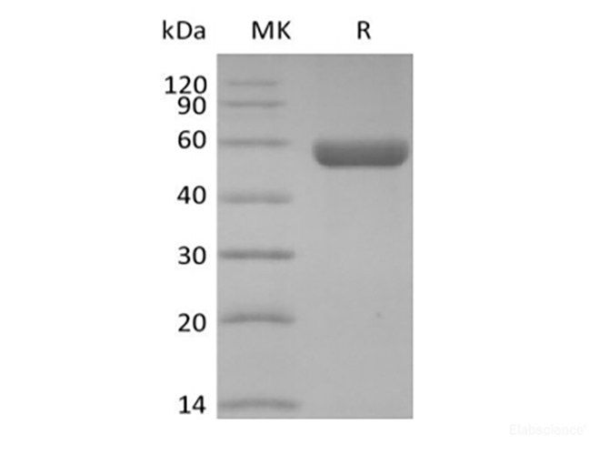 Recombinant Human HLA-A*0201 GP100 complex Protein (C-10His)