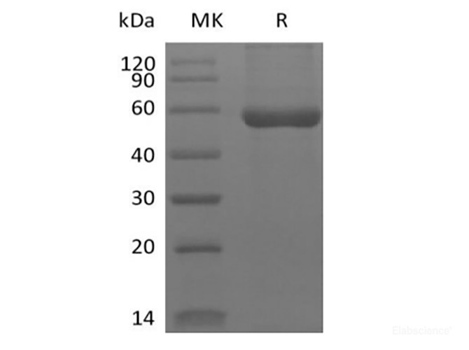 Recombinant Human HLA-A*0201 WT-1 complex Protein (C-10His)