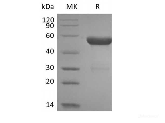 Recombinant Human HLA-A*0201 HPV16 E7 complex Protein (C-10His)