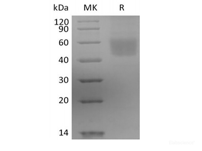 Recombinant Human IL-3 Receptor Subunit Alpha/IL-3RA/CD123 (C-6His)