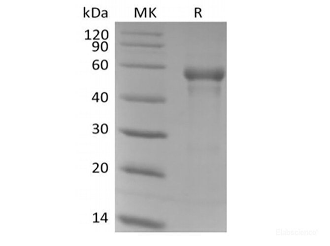 Recombinant Human B3GAT1 (N-6His)