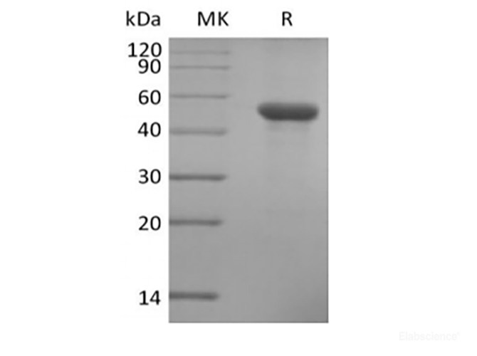 Recombinant Human ILDR2 (C-6His)