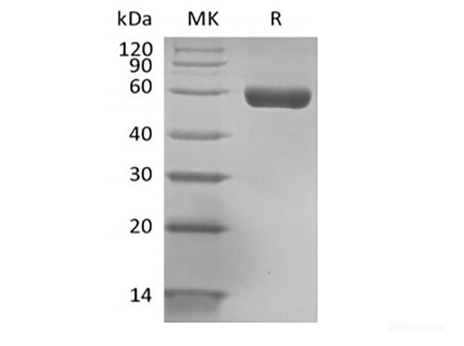 Recombinant Human HLA-A*0201 GP100 complex Protein (C-Avi-10His) Biotinylated