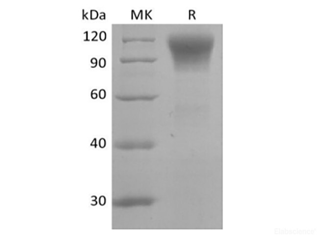 Recombinant Human CD45R0 (C-6His)