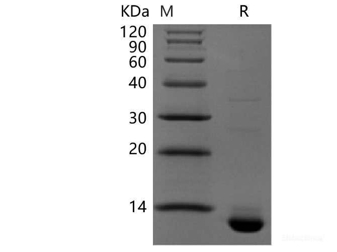 Recombinant Human CLDN18.2(N-6His,C-Avi)