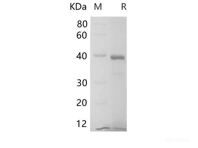 Recombinant Human IL6R protein (His Tag)