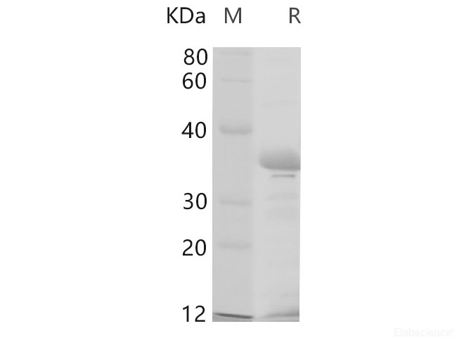 Recombinant Human CDH1 Protein (His Tag)