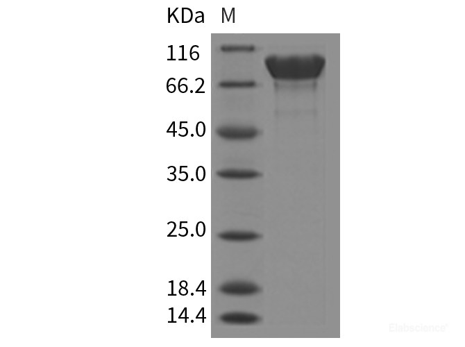 Recombinant Mouse APLP1 / Amyloid-like Protein (His Tag)-Elabscience