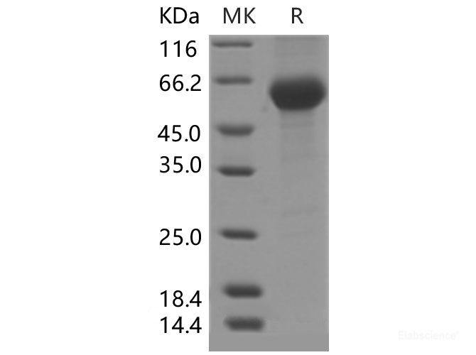 Recombinant Mouse PLA2G7 / PAFAH Protein (His Tag)-Elabscience