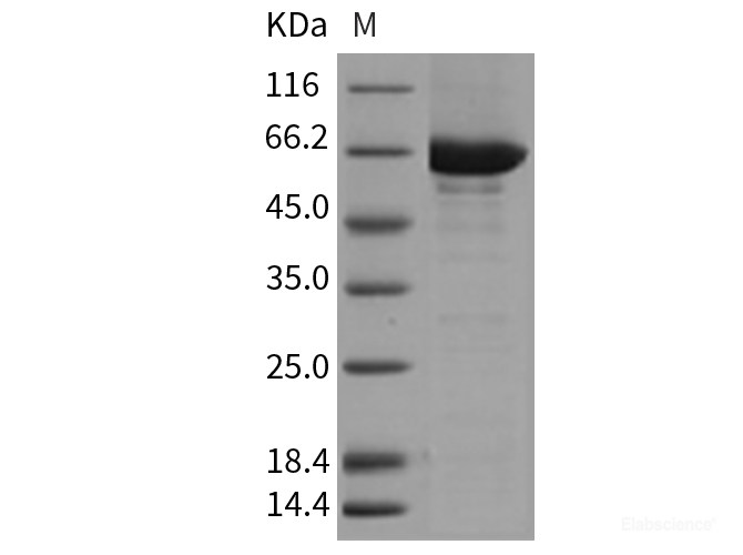 Recombinant Mouse CSK / C-Src kinase Protein (His & GST tag)-Elabscience