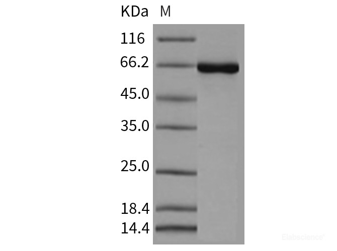 Recombinant Mouse CSNK2A1 / CK2A1 Protein (His & GST tag)-Elabscience