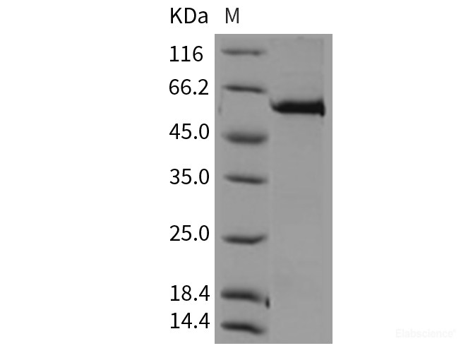 Recombinant Mouse MERTK / Mer Protein (His & GST tag)-Elabscience
