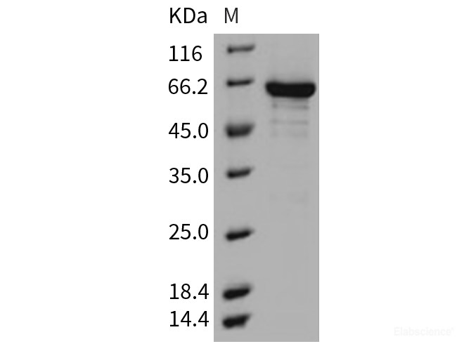 Recombinant Mouse EphB1 / EPHT2 Protein (His & GST tag)-Elabscience