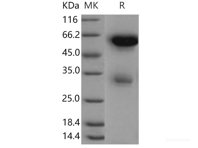 Recombinant Mouse  Legumain Protein (His Tag)-Elabscience