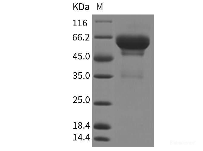 Recombinant Mouse SCG3 / Secretogranin 3 Protein (His Tag)-Elabscience