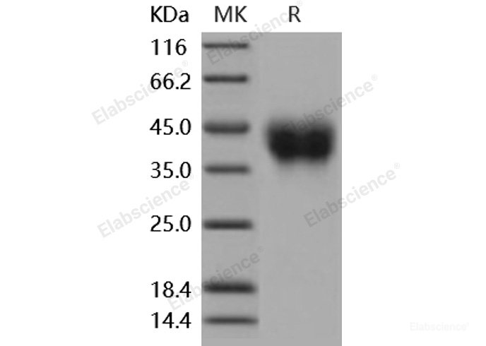 Recombinant Mouse CD200 Protein (His tag)-Elabscience