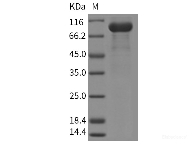 Recombinant Mouse Osteoprotegerin / TNFRSF11B Protein (Fc Tag)-Elabscience