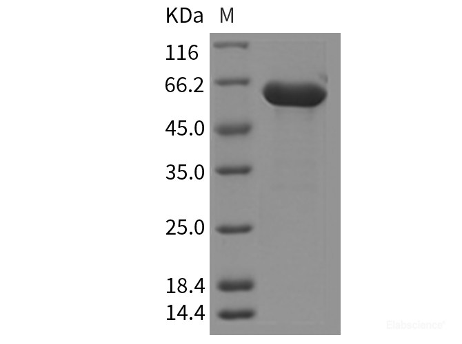 Recombinant Mouse HEXB / Hexosaminidase B Protein (His Tag)-Elabscience
