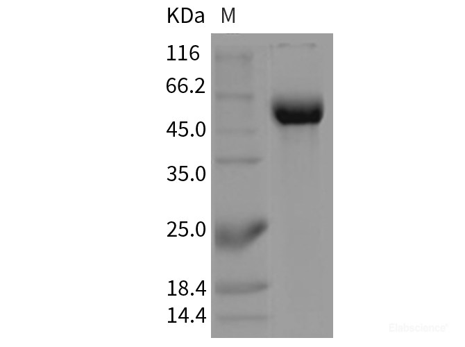 Recombinant Mouse Siglec-2 / CD22 Protein (Fc tag)-Elabscience