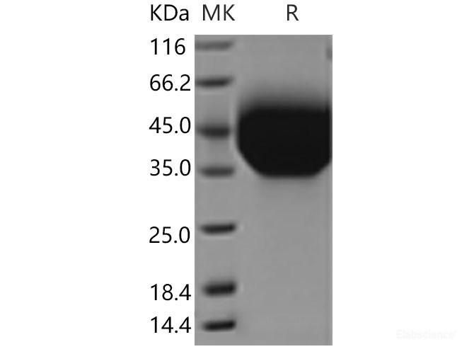 Recombinant Mouse  TIM-3 Protein (His Tag)-Elabscience