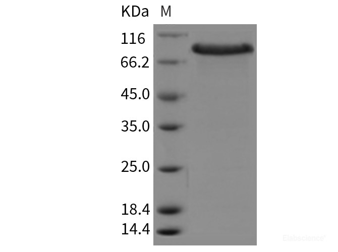 Recombinant Mouse CRELD1 Protein (ECD, Fc Tag)-Elabscience