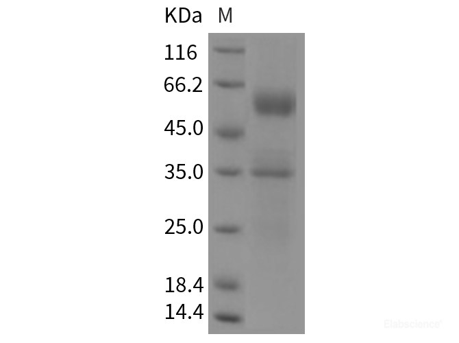 Recombinant Mouse FLT3L / Flt3 ligand Protein (Fc tag)-Elabscience