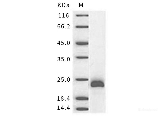 Recombinant Mouse  ESM1 Protein (His Tag)-Elabscience