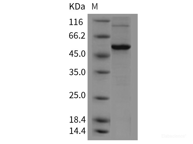 Recombinant Mouse VDR / NR1I1 Protein (His tag)-Elabscience
