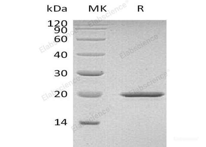 Recombinant Mouse  Sonic Hedgehog Protein (His Tag)-Elabscience
