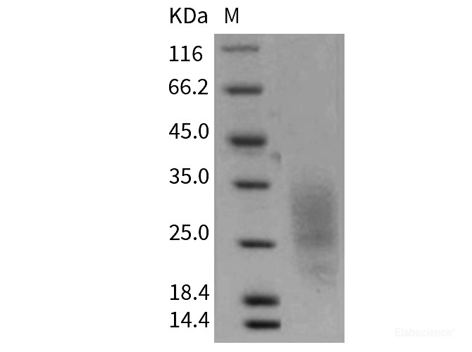 Recombinant Mouse LAIR1 Protein (His tag)-Elabscience