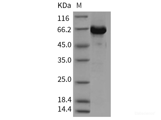 Recombinant Mouse AKT3 Protein (aa 106-479, His & GST tag)-Elabscience