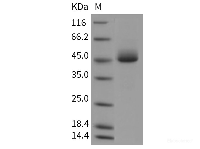 Recombinant Mouse Prostatic Acid Phosphatase / ACPP Protein (His tag)-Elabscience