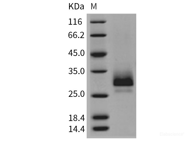 Recombinant Mouse TFPI2 / PP5 Protein (His tag)-Elabscience