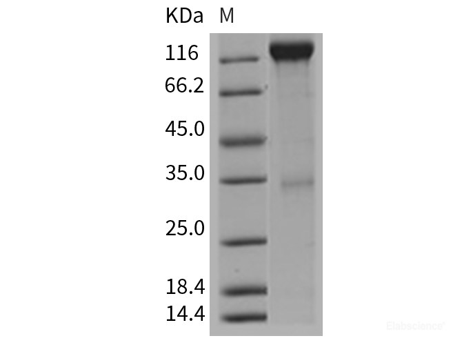 Recombinant Mouse VEGFR2 / Flk-1 / CD309 / KDR Protein (Fc tag)-Elabscience