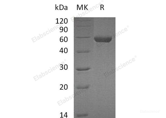 Recombinant Mouse  Carboxypeptidase M Protein (His Tag)-Elabscience