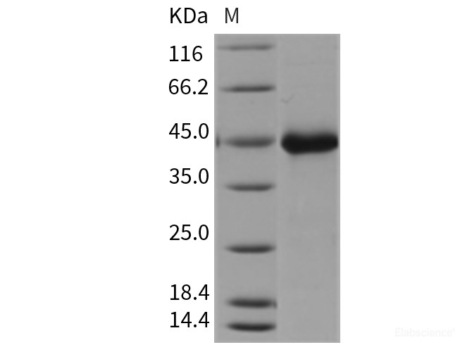 Recombinant Mouse WIF1 / WIF-1 Protein (His tag)-Elabscience