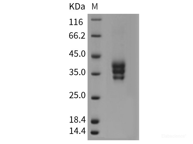 Recombinant Mouse ESAM / Endothelial Cell Adhesion Molecule Protein (His tag)-Elabscience