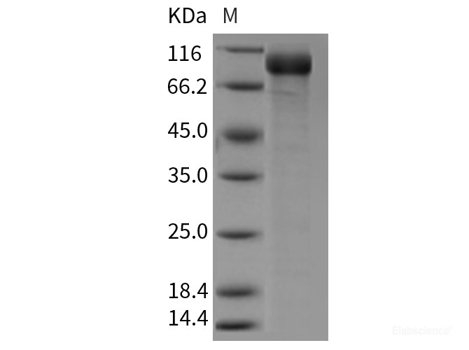 Recombinant Mouse Semaphorin 5A / SEMA5A Protein (His tag)-Elabscience