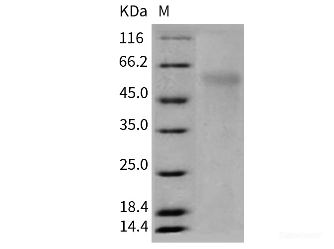 Recombinant Mouse NGFR Protein (His Tag)-Elabscience