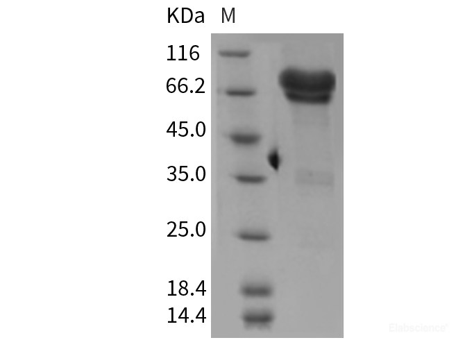Recombinant Mouse NGFR / P75 Protein (Fc tag)-Elabscience
